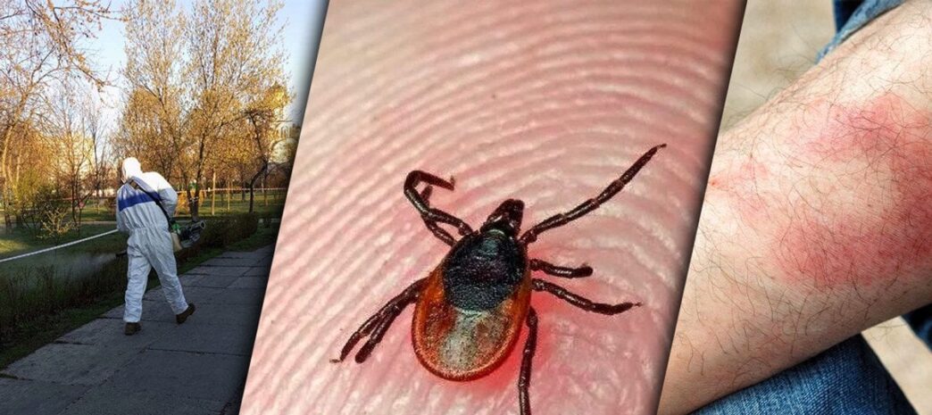 Хвороба Лайма в Києві 2026: симптоми, ризики та профілактика 3