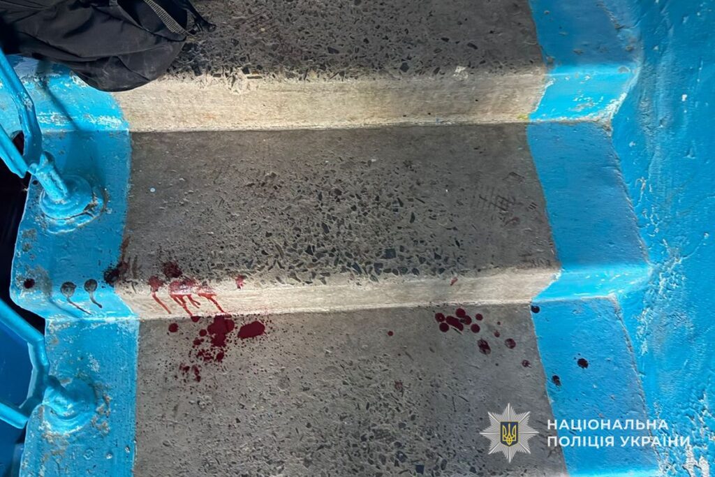 15-річна школярка в Тернополі напала з ножем на однокласницю: уламок залишився в тілі, справа про замах на вбивство 7