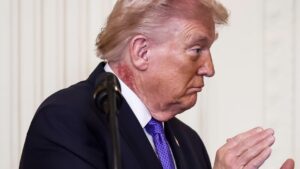 Вага та таємниця синців Трампа. Медики оприлюднили результати обстеження 29