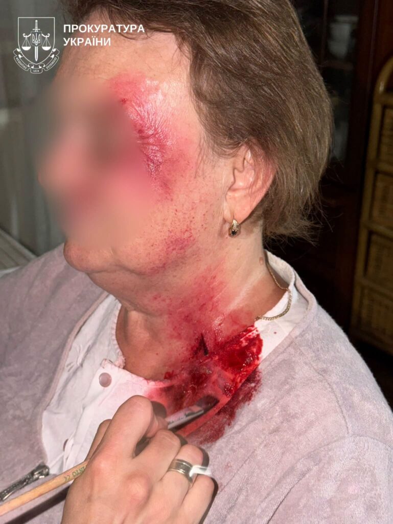 Микола Поліщук 70-річний київський хірург замовив вбивство дружини за $10 000 6 Микола Поліщук 70-річний київський хірург замовив вбивство дружини за $10 000 5