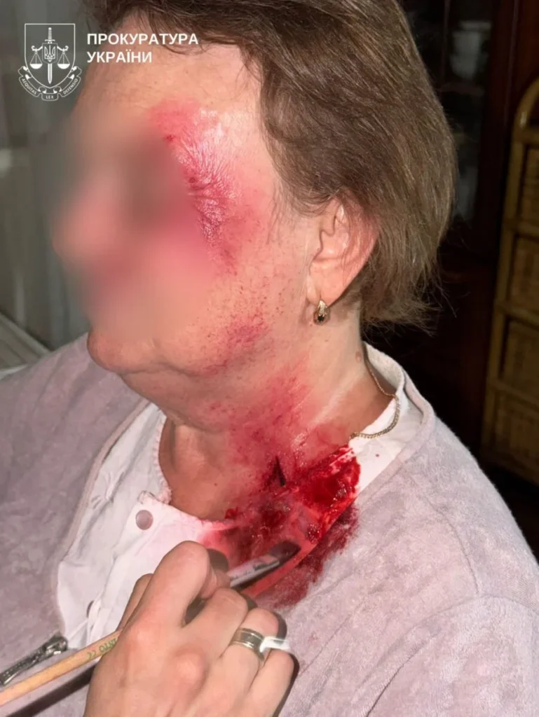 Микола Поліщук 70-річний київський хірург замовив вбивство дружини за $10 000 6 Микола Поліщук 70-річний київський хірург замовив вбивство дружини за $10 000 5
