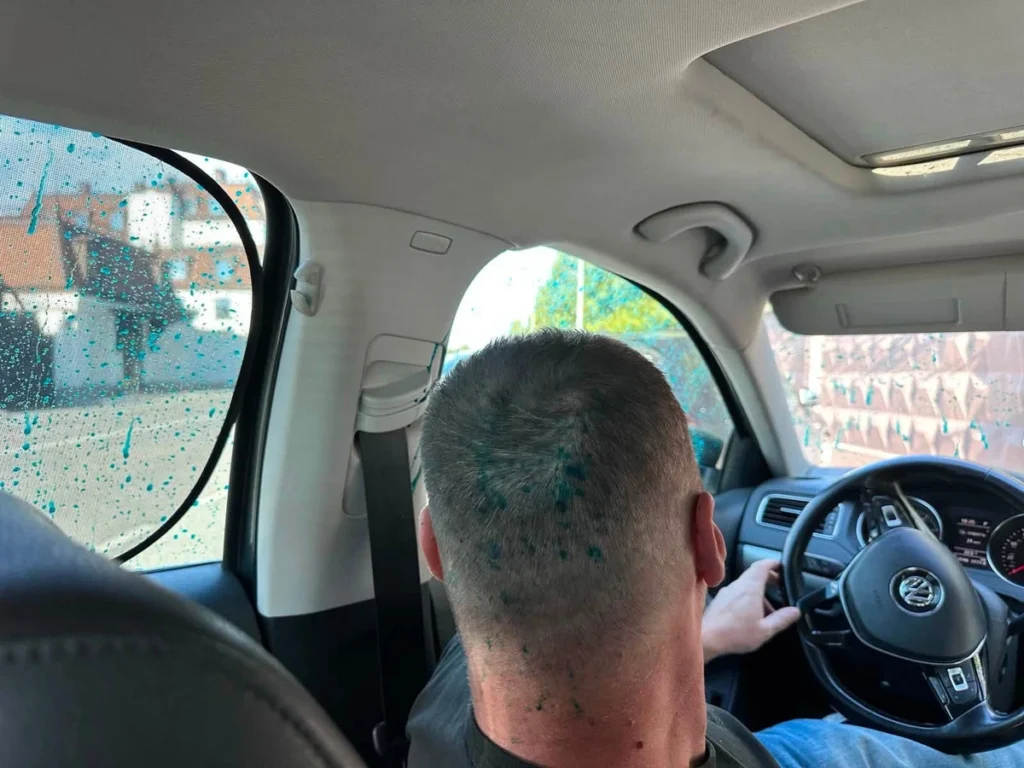 Напад на журналістів УП зеленкою: деталі інциденту біля готелю Кривецького 8 Напад на журналістів УП зеленкою: деталі інциденту біля готелю Кривецького 7