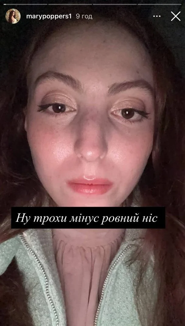 Дочка Олі Полякової Маша показала фото після ДТП: перелом носа та травма очниці 10 Дочка Олі Полякової Маша показала фото після ДТП: перелом носа та травма очниці 9