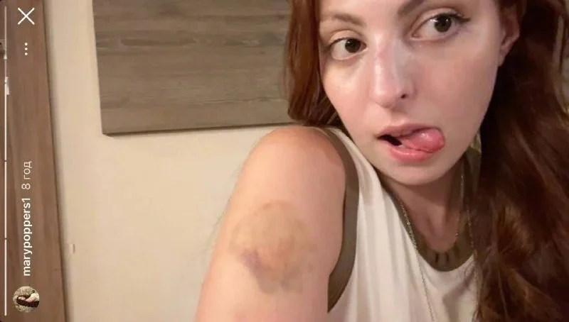 Дочка Олі Полякової Маша показала фото після ДТП: перелом носа та травма очниці 6 Дочка Олі Полякової Маша показала фото після ДТП: перелом носа та травма очниці 5